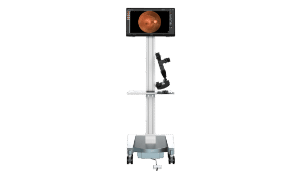 vidÉo indirecte ophthalmoscope